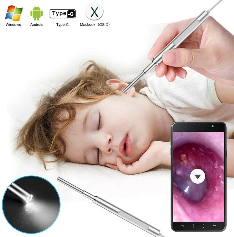 allesxl3167794